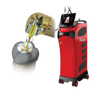 BioLase Waterlase iX Laser System